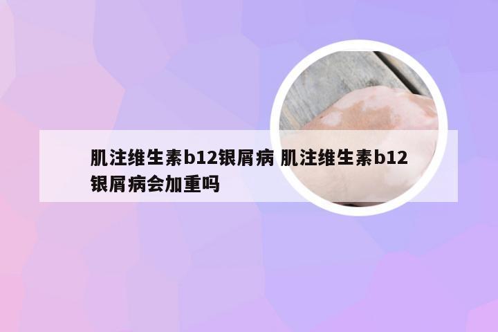 肌注维生素b12银屑病 肌注维生素b12银屑病会加重吗