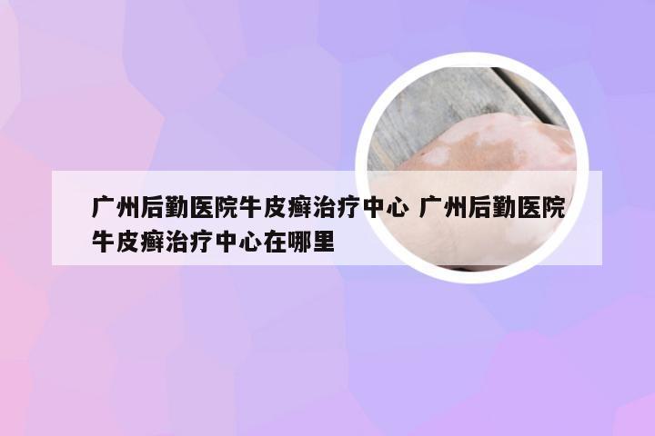广州后勤医院牛皮癣治疗中心 广州后勤医院牛皮癣治疗中心在哪里