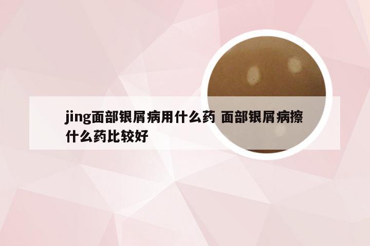 jing面部银屑病用什么药 面部银屑病擦什么药比较好