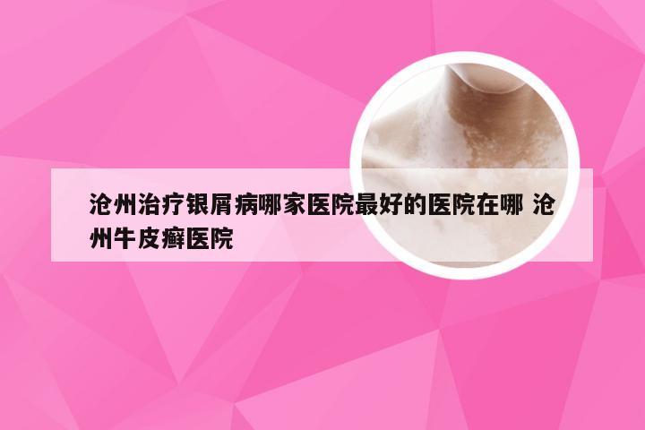 沧州治疗银屑病哪家医院最好的医院在哪 沧州牛皮癣医院