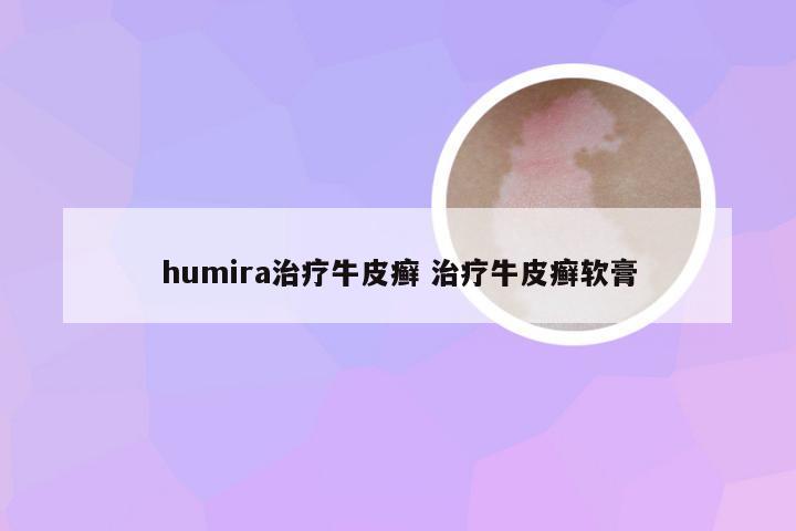 humira治疗牛皮癣 治疗牛皮癣软膏