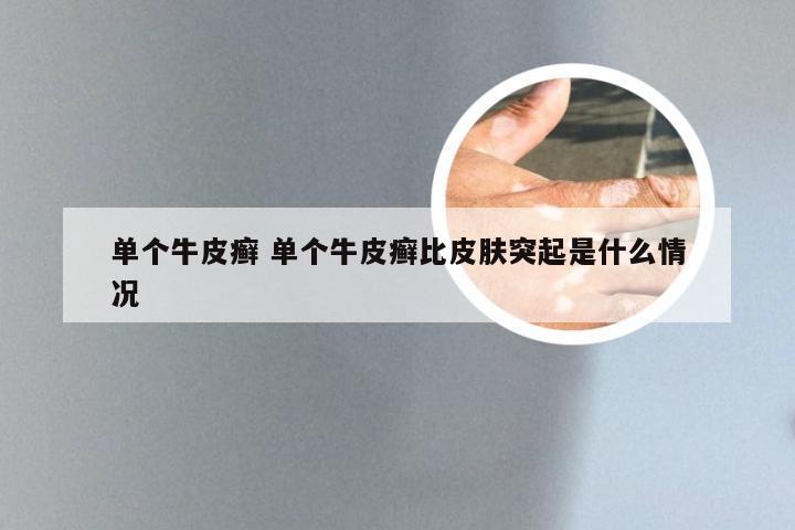 单个牛皮癣 单个牛皮癣比皮肤突起是什么情况