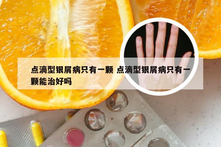 点滴型银屑病只有一颗 点滴型银屑病只有一颗能治好吗