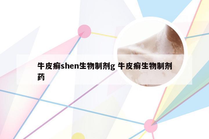 牛皮癣shen生物制剂g 牛皮癣生物制剂药