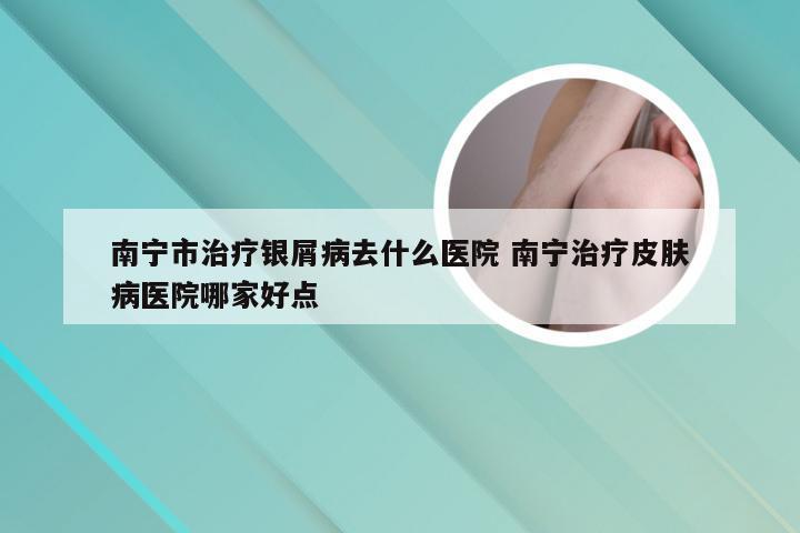 南宁市治疗银屑病去什么医院 南宁治疗皮肤病医院哪家好点