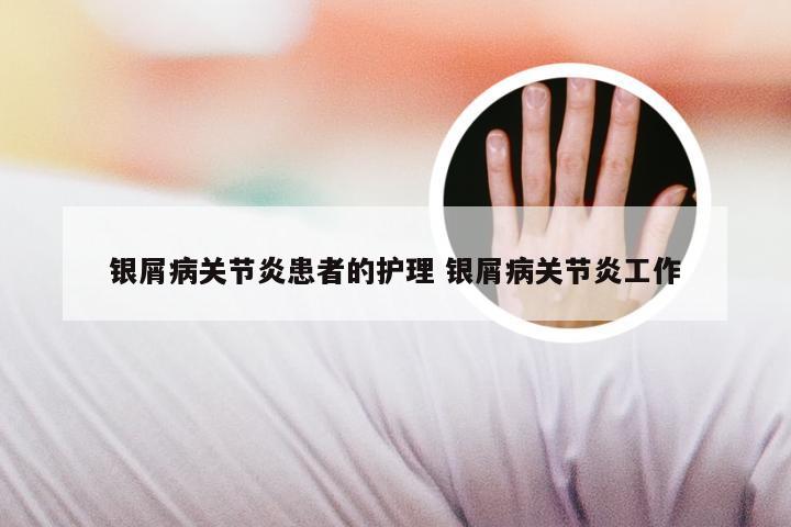银屑病关节炎患者的护理 银屑病关节炎工作