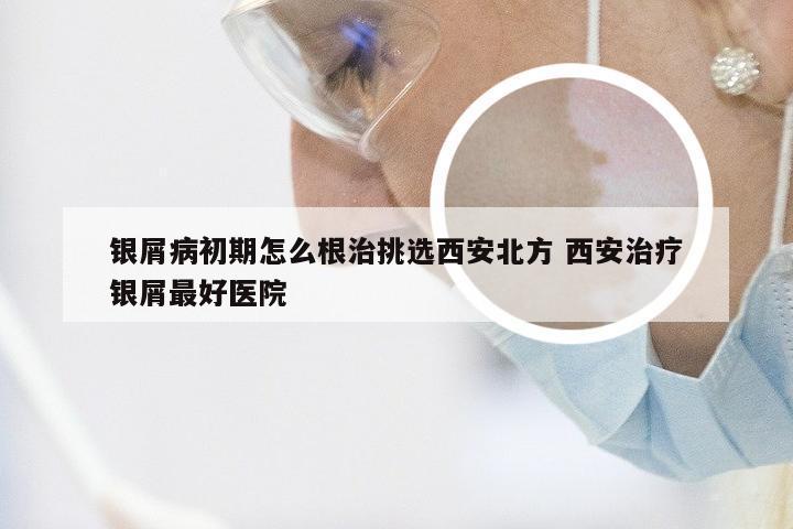 银屑病初期怎么根治挑选西安北方 西安治疗银屑最好医院