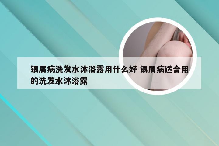 银屑病洗发水沐浴露用什么好 银屑病适合用的洗发水沐浴露