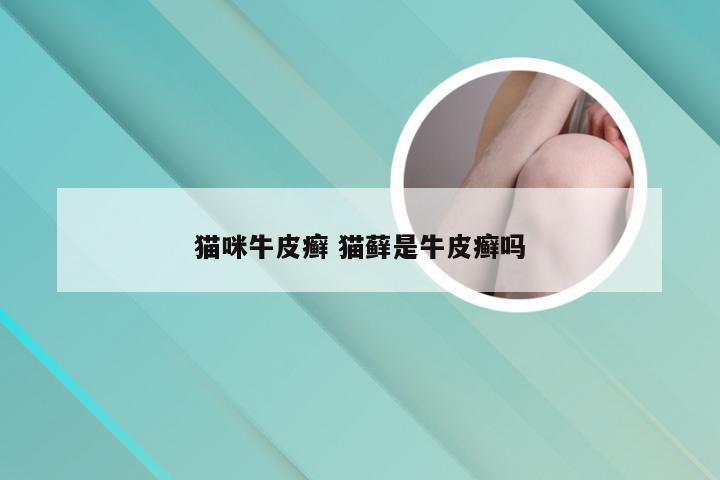 猫咪牛皮癣 猫藓是牛皮癣吗