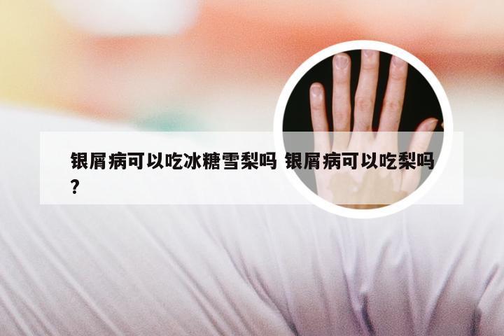 银屑病可以吃冰糖雪梨吗 银屑病可以吃梨吗?