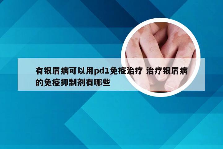 有银屑病可以用pd1免疫治疗 治疗银屑病的免疫抑制剂有哪些