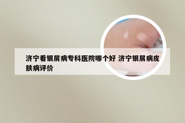 济宁看银屑病专科医院哪个好 济宁银屑病皮肤病评价