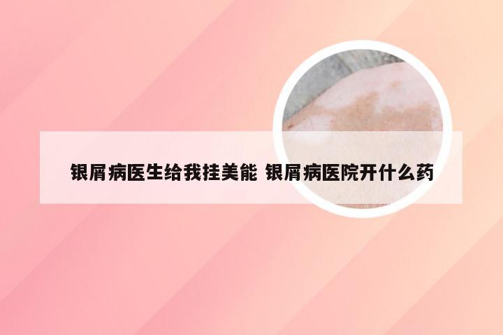 银屑病医生给我挂美能 银屑病医院开什么药