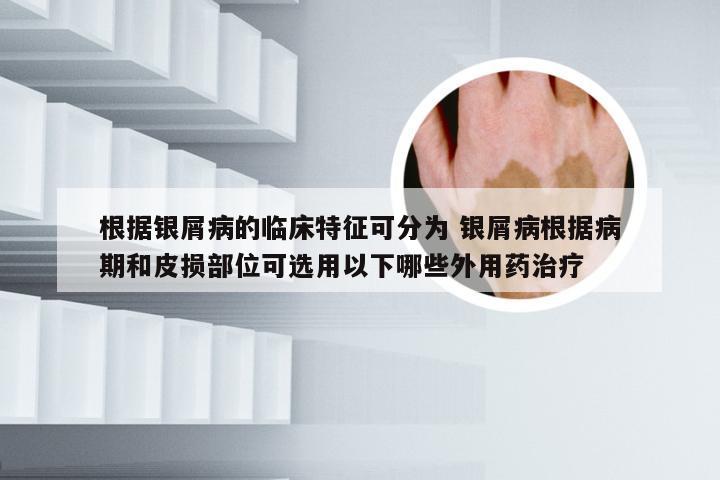 根据银屑病的临床特征可分为 银屑病根据病期和皮损部位可选用以下哪些外用药治疗