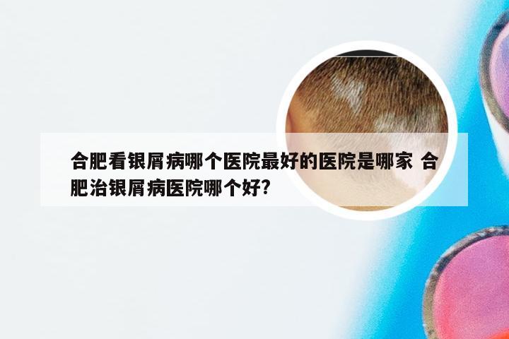 合肥看银屑病哪个医院最好的医院是哪家 合肥治银屑病医院哪个好?