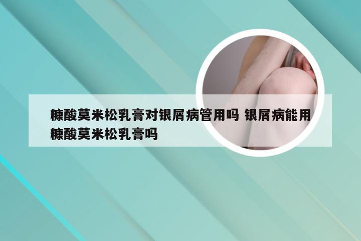 糠酸莫米松乳膏对银屑病管用吗 银屑病能用糠酸莫米松乳膏吗