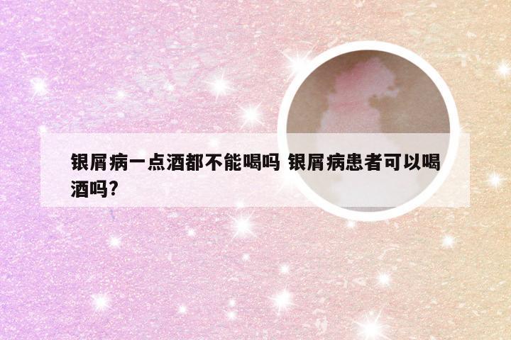 银屑病一点酒都不能喝吗 银屑病患者可以喝酒吗?