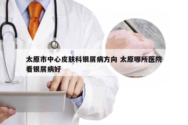 太原市中心皮肤科银屑病方向 太原哪所医院看银屑病好