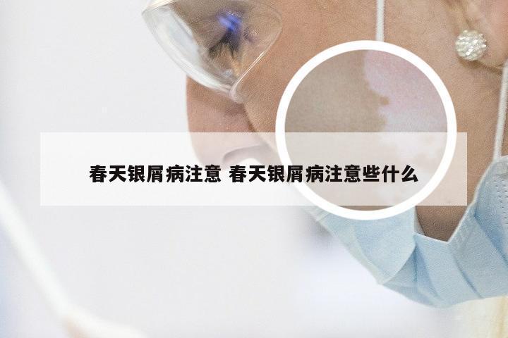 春天银屑病注意 春天银屑病注意些什么