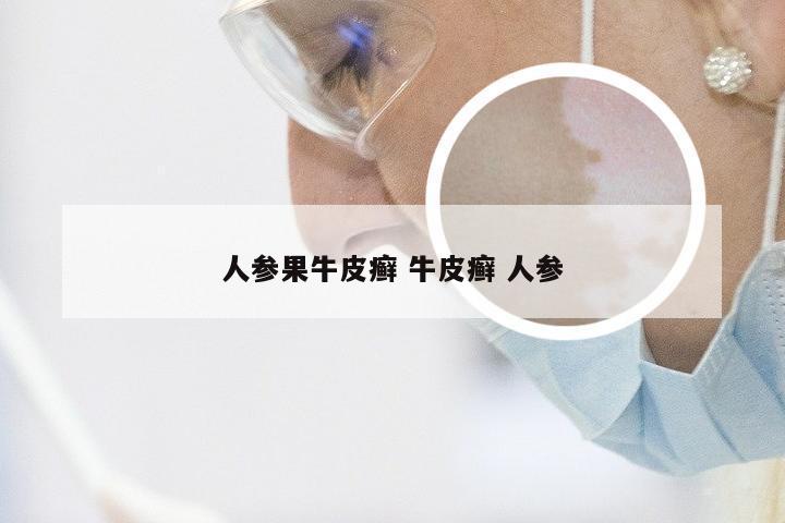 人参果牛皮癣 牛皮癣 人参