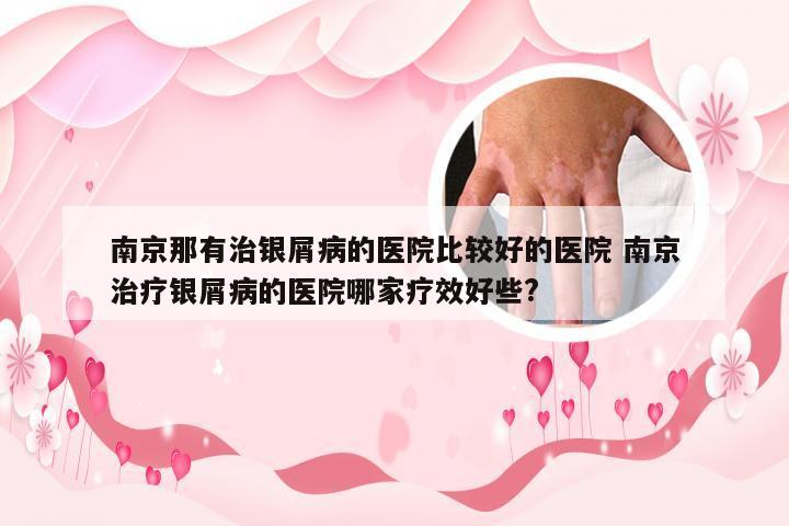 南京那有治银屑病的医院比较好的医院 南京治疗银屑病的医院哪家疗效好些?