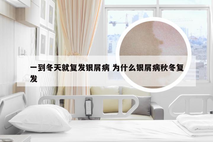 一到冬天就复发银屑病 为什么银屑病秋冬复发