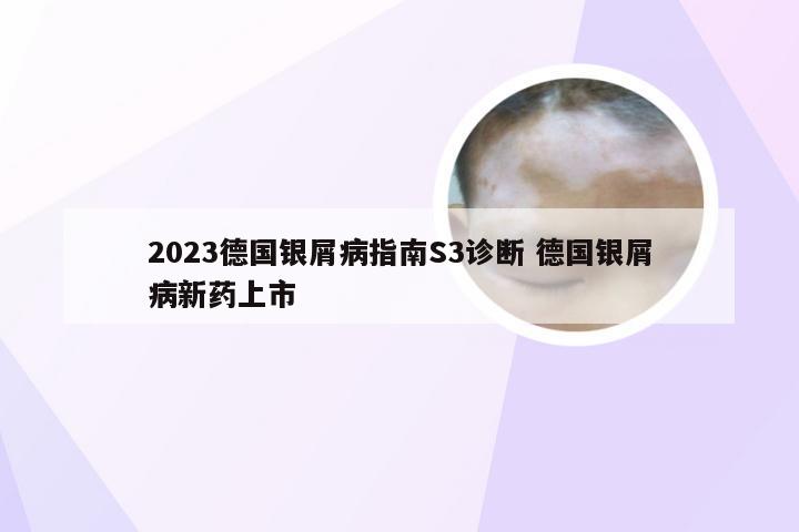 2023德国银屑病指南S3诊断 德国银屑病新药上市