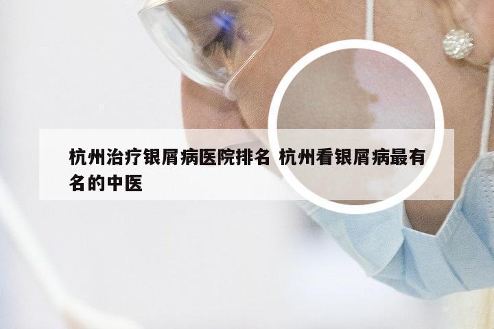 杭州治疗银屑病医院排名 杭州看银屑病最有名的中医