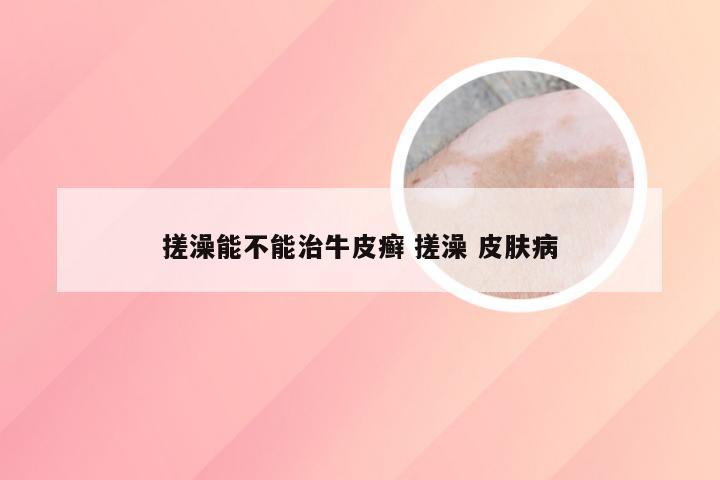 搓澡能不能治牛皮癣 搓澡 皮肤病
