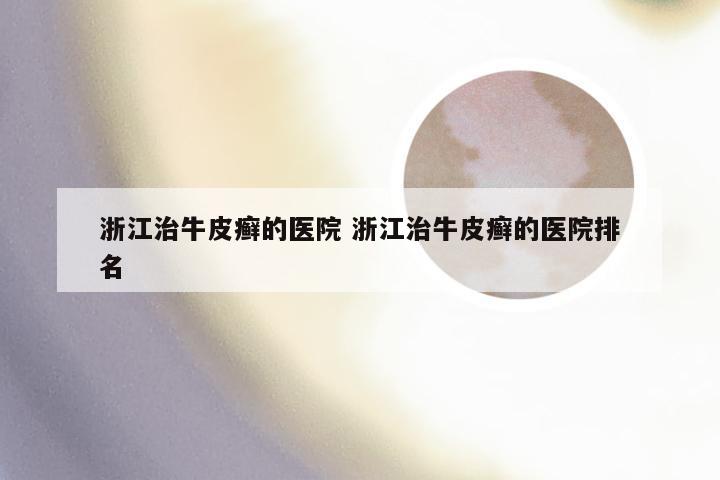 浙江治牛皮癣的医院 浙江治牛皮癣的医院排名