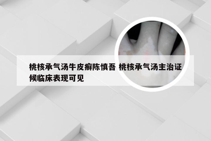 桃核承气汤牛皮癣陈慎吾 桃核承气汤主治证候临床表现可见