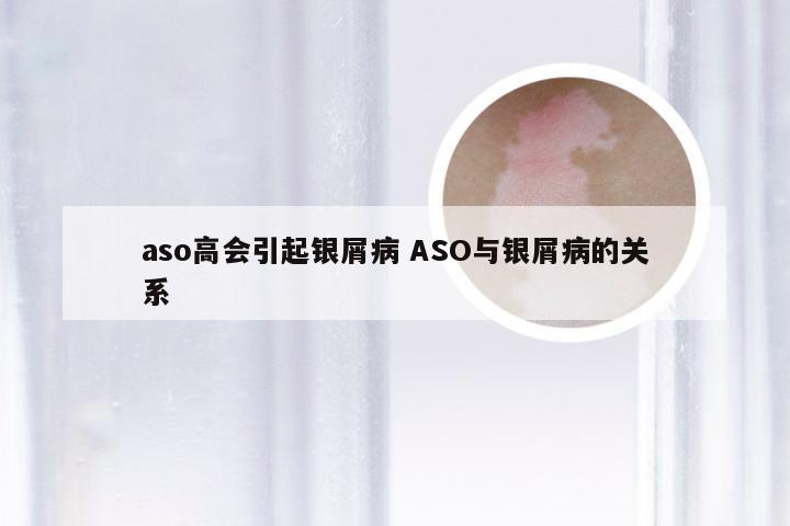 aso高会引起银屑病 ASO与银屑病的关系