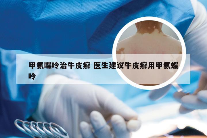 甲氨喋呤治牛皮癣 医生建议牛皮癣用甲氨蝶呤