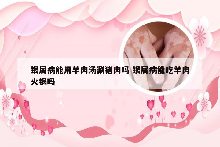 银屑病能用羊肉汤涮猪肉吗 银屑病能吃羊肉火锅吗
