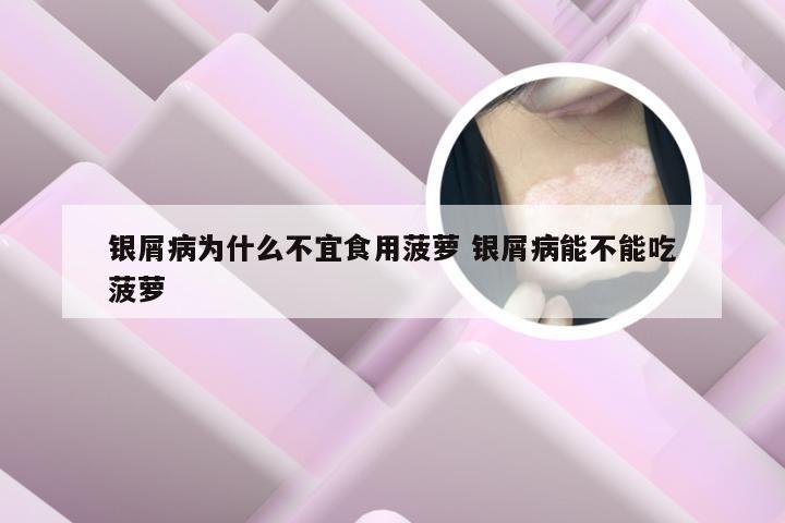 银屑病为什么不宜食用菠萝 银屑病能不能吃菠萝
