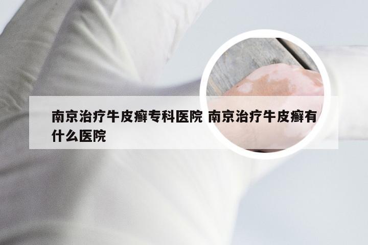 南京治疗牛皮癣专科医院 南京治疗牛皮癣有什么医院