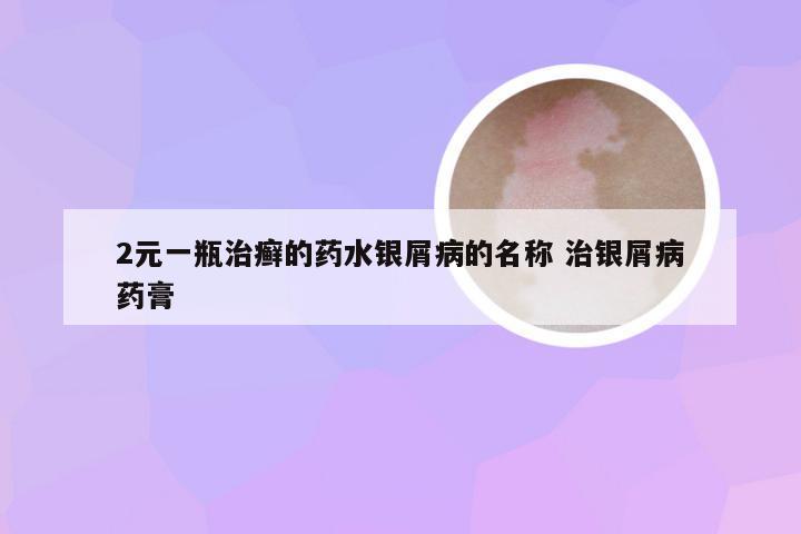 2元一瓶治癣的药水银屑病的名称 治银屑病药膏