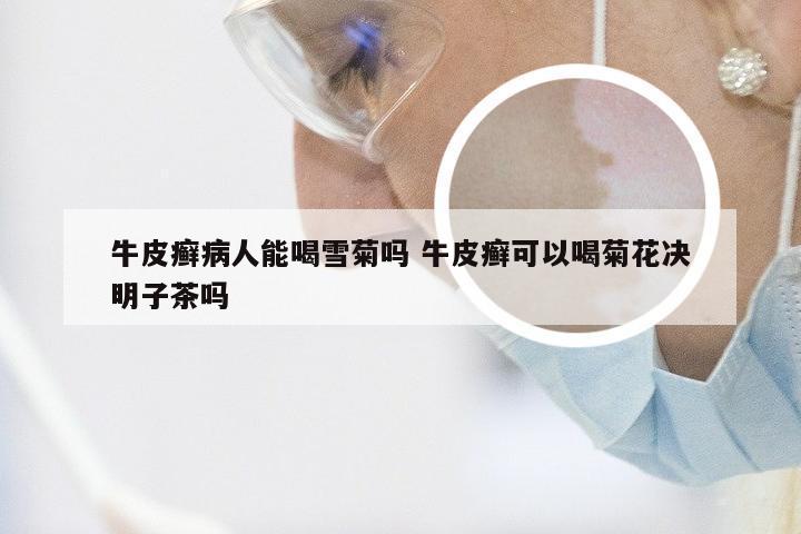 牛皮癣病人能喝雪菊吗 牛皮癣可以喝菊花决明子茶吗