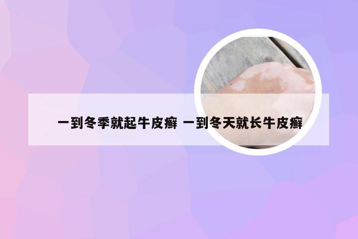 一到冬季就起牛皮癣 一到冬天就长牛皮癣