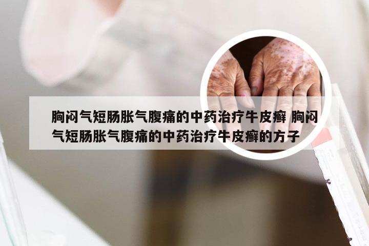胸闷气短肠胀气腹痛的中药治疗牛皮癣 胸闷气短肠胀气腹痛的中药治疗牛皮癣的方子