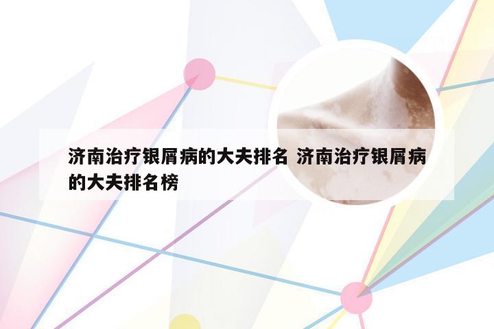 济南治疗银屑病的大夫排名 济南治疗银屑病的大夫排名榜