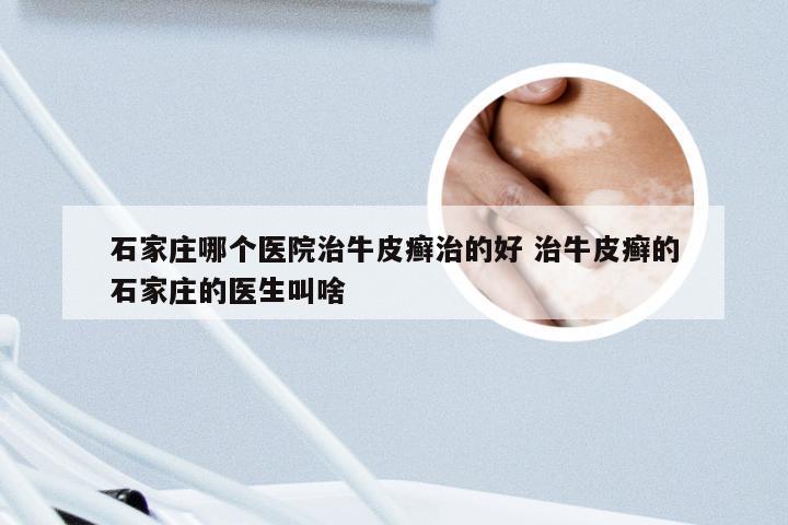 石家庄哪个医院治牛皮癣治的好 治牛皮癣的石家庄的医生叫啥