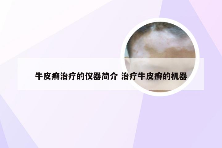 牛皮癣治疗的仪器简介 治疗牛皮癣的机器