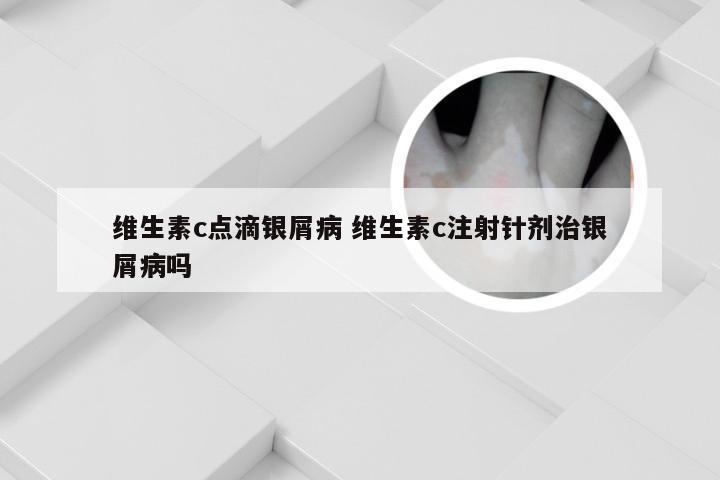维生素c点滴银屑病 维生素c注射针剂治银屑病吗