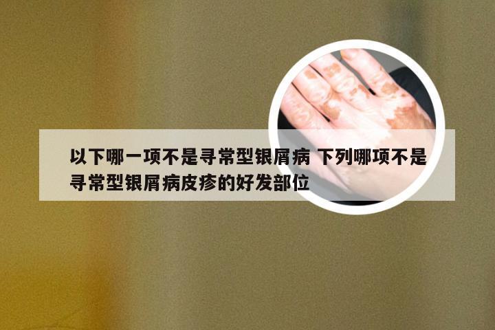 以下哪一项不是寻常型银屑病 下列哪项不是寻常型银屑病皮疹的好发部位