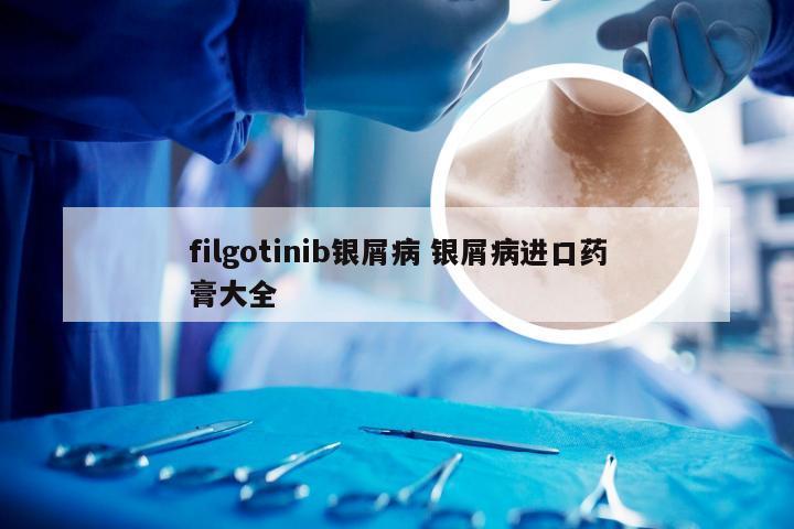 filgotinib银屑病 银屑病进口药膏大全