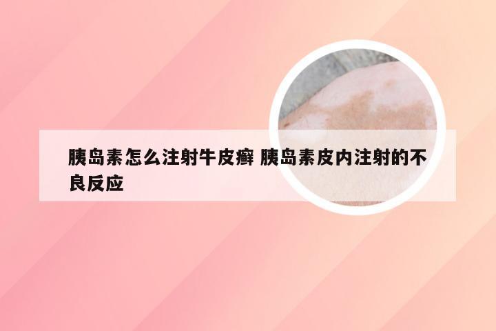 胰岛素怎么注射牛皮癣 胰岛素皮内注射的不良反应