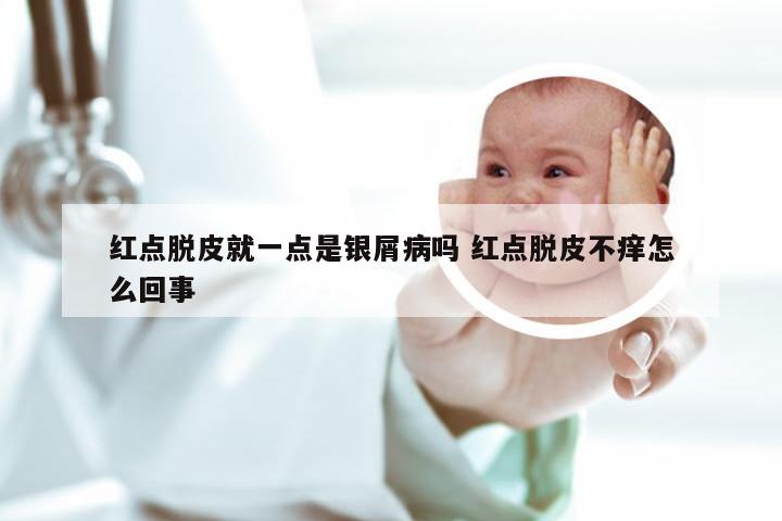 红点脱皮就一点是银屑病吗 红点脱皮不痒怎么回事