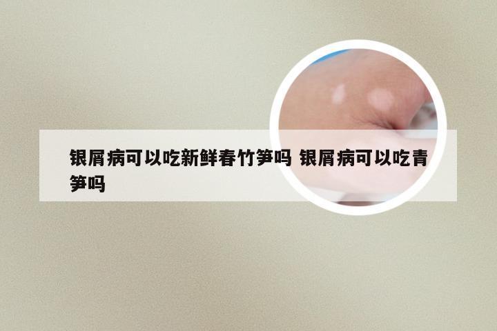 银屑病可以吃新鲜春竹笋吗 银屑病可以吃青笋吗