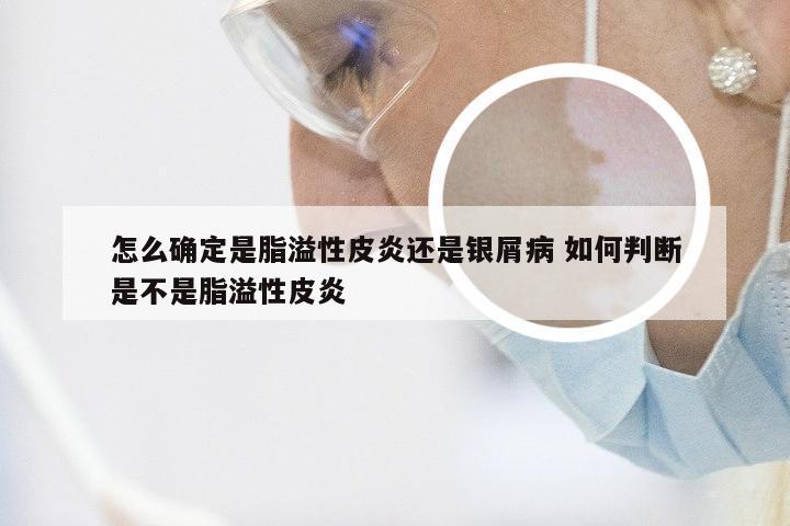 怎么确定是脂溢性皮炎还是银屑病 如何判断是不是脂溢性皮炎